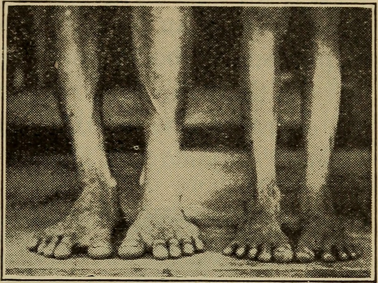 page from a 19th century anatomy textbook showing the brain